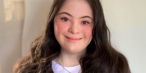Ellie Goldstein, a model with Down syndrome chosen by Gucci